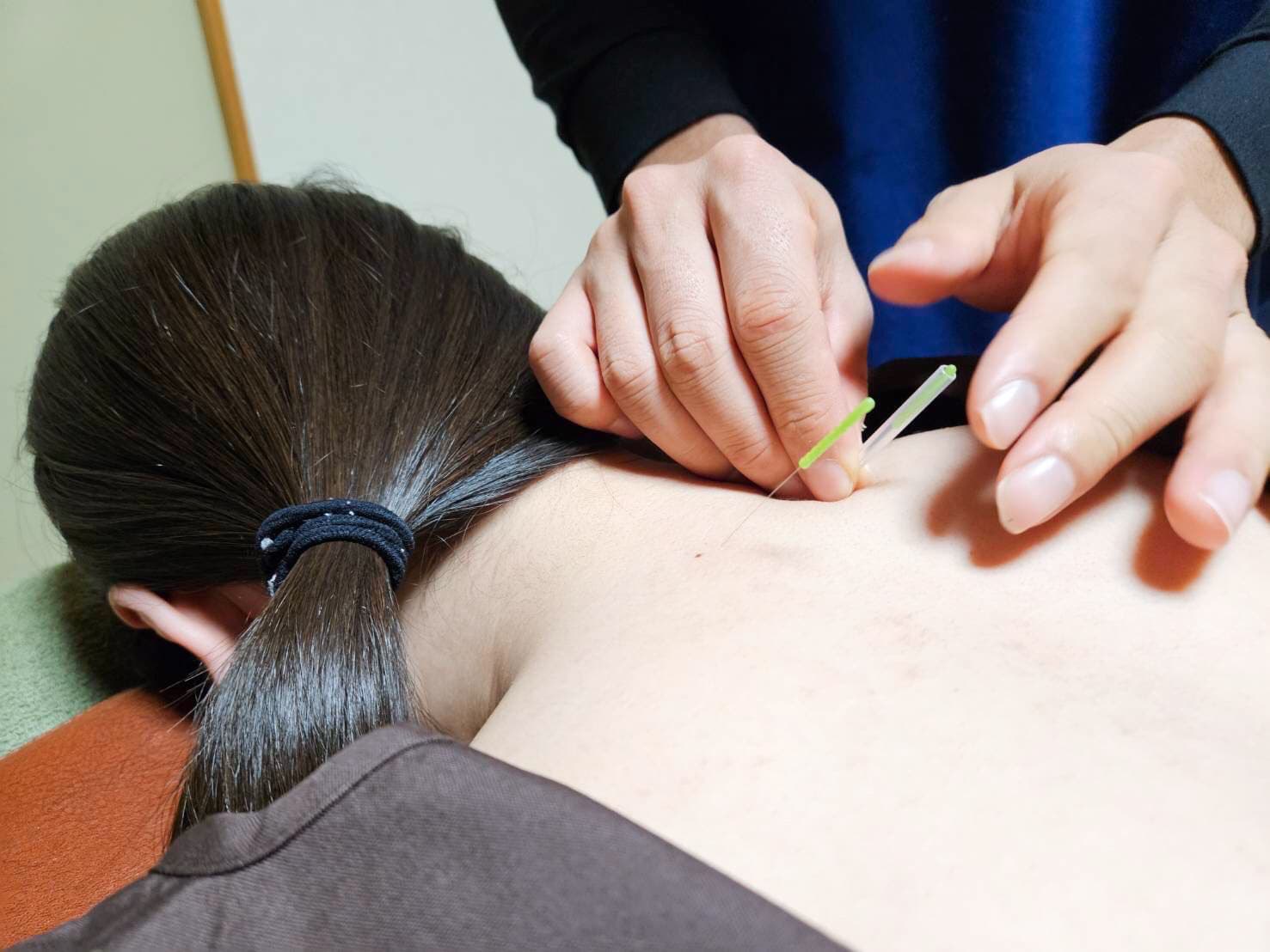 Acupuncture Tools